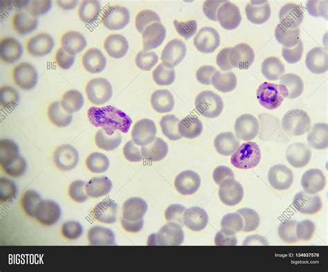  Plasmodium! A Microscopic Parasite That Hijacks Your Blood Cells